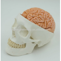 Adult Skull with Brain